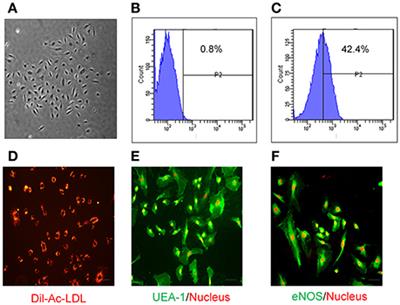 Role of NADPH Oxidase-4 in Human Endothelial Progenitor Cells